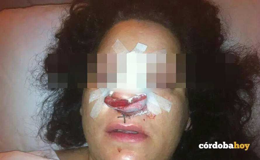Mujer apalizada por polic&iacute;as en C&oacute;rdoba en 2013. FOTO APDHA