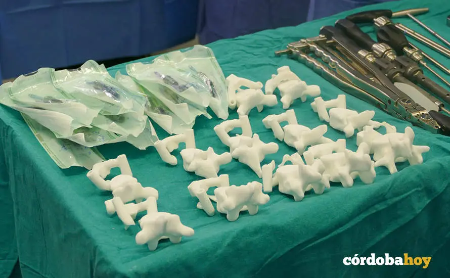 Gu&iacute;as personalizadas para operaci&oacute;n de columna impresas en 3D FOTO HOSPITAL SAN JUAN DE DIOS