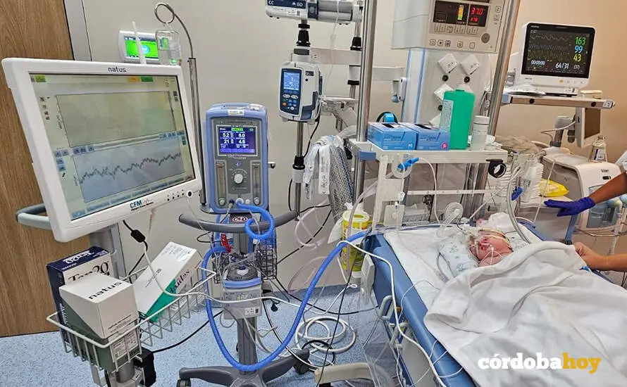 Un beb&eacute; recibe monitorizaci&oacute;n cerebral en la unidad de neonatolog&iacute;a del Hospital San Juan de Dios