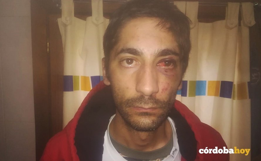 Activista agredido por la Policía Nacional en Córdoba