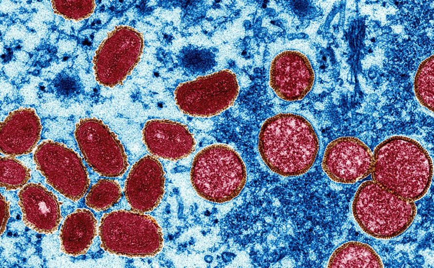Imagen del virus de la viruela del mono. FOTO NATIONAL GEOGRAPHIC