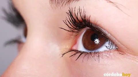 ojo glaucoma