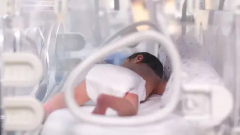  Un bebe en una UCI pedi&aacute;trica