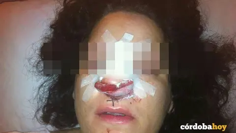 Mujer apalizada por polic&iacute;as en C&oacute;rdoba en 2013. FOTO APDHA