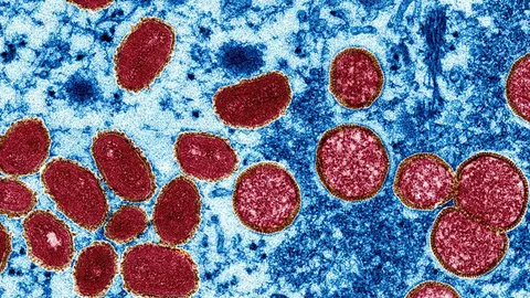 Imagen del virus de la viruela del mono. FOTO NATIONAL GEOGRAPHIC
