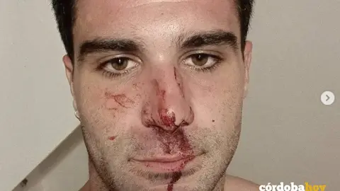 Estado en que qued&oacute; el agredido y que public&oacute; en sus redes sociales