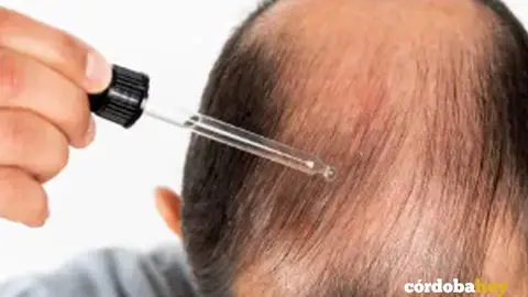 CALVO