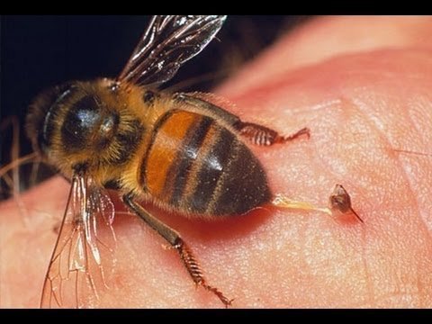 abeja picadura